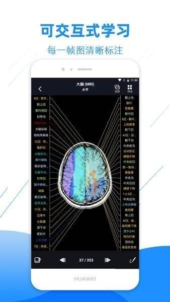 影像解剖图谱app破解版下载  
